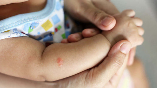 Best Mosquito Repellent Stickers for Babies in 2024